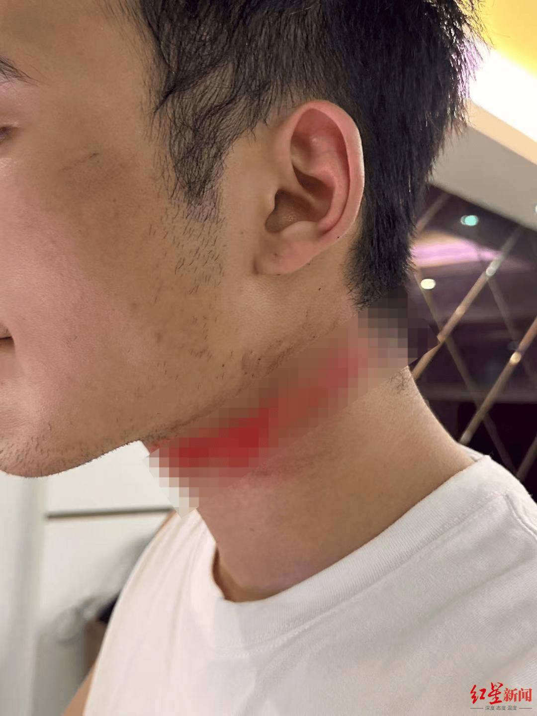 皇冠信用網APP下载
_男主播骑车载女友回家被路边掉落网线勒伤脖子皇冠信用網APP下载
，索赔3万陷僵局 律师解读该谁赔