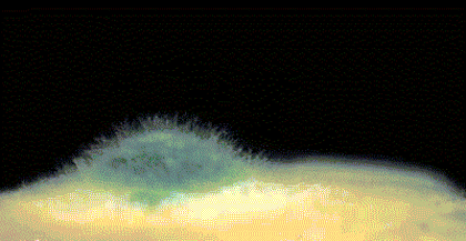 皇冠信用网代理注册_6岁女童发烧17天皇冠信用网代理注册，脑子竟被“啃”出十几个洞！“元凶”家中很常见！