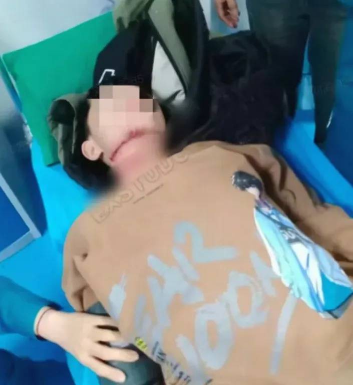 皇冠世界杯盘口_河南13岁被锁喉男孩赴京治疗后已脱离生命危险皇冠世界杯盘口，拉绳老人已被采取刑事强制措施